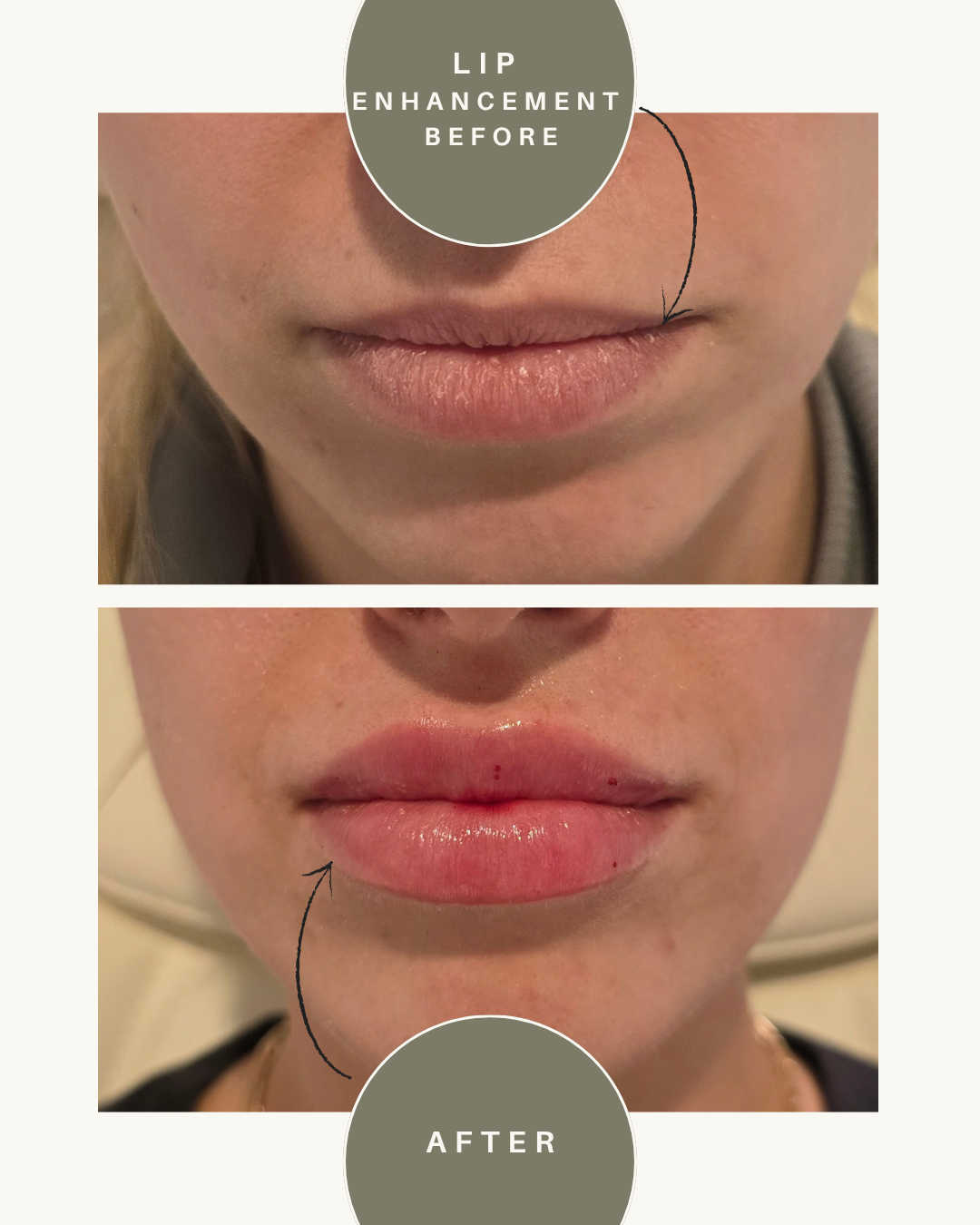 before and after