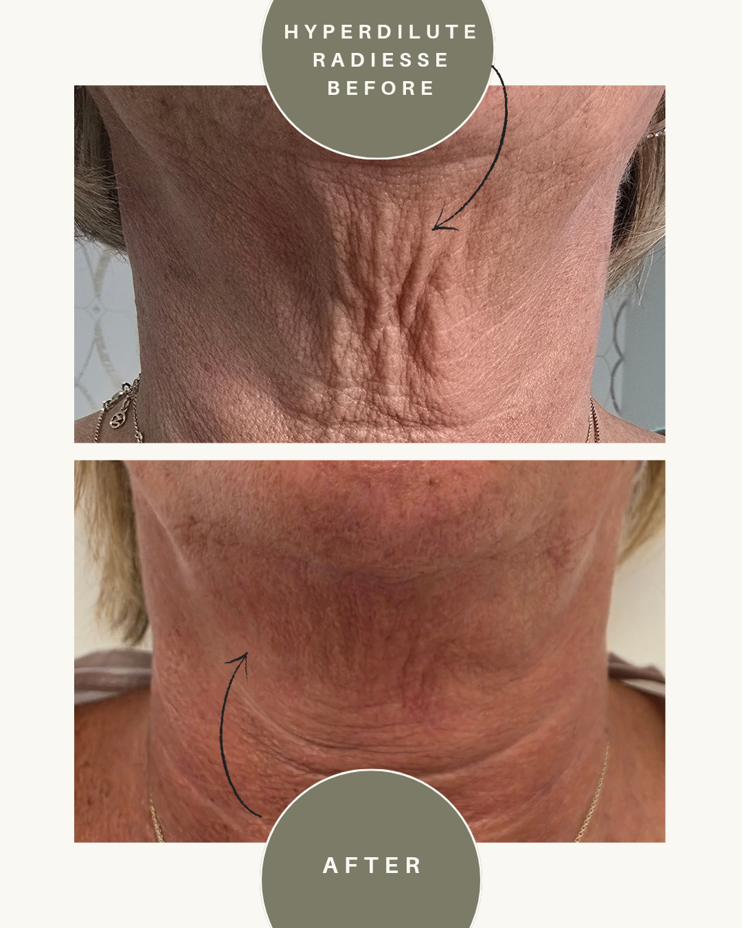 before and after