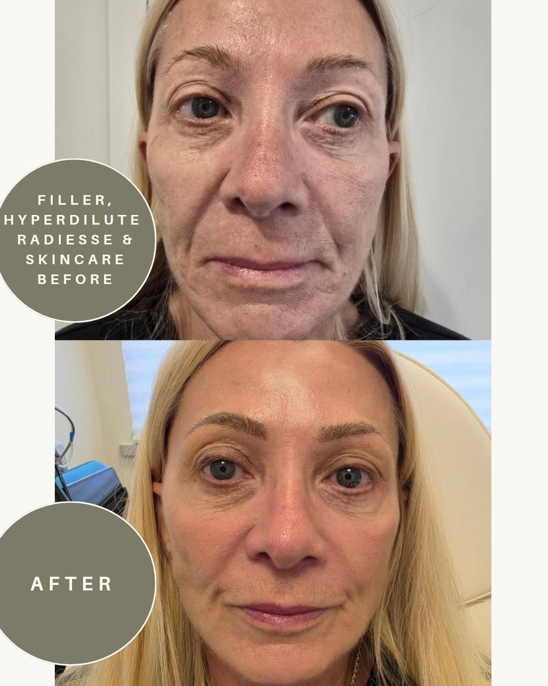 before and after