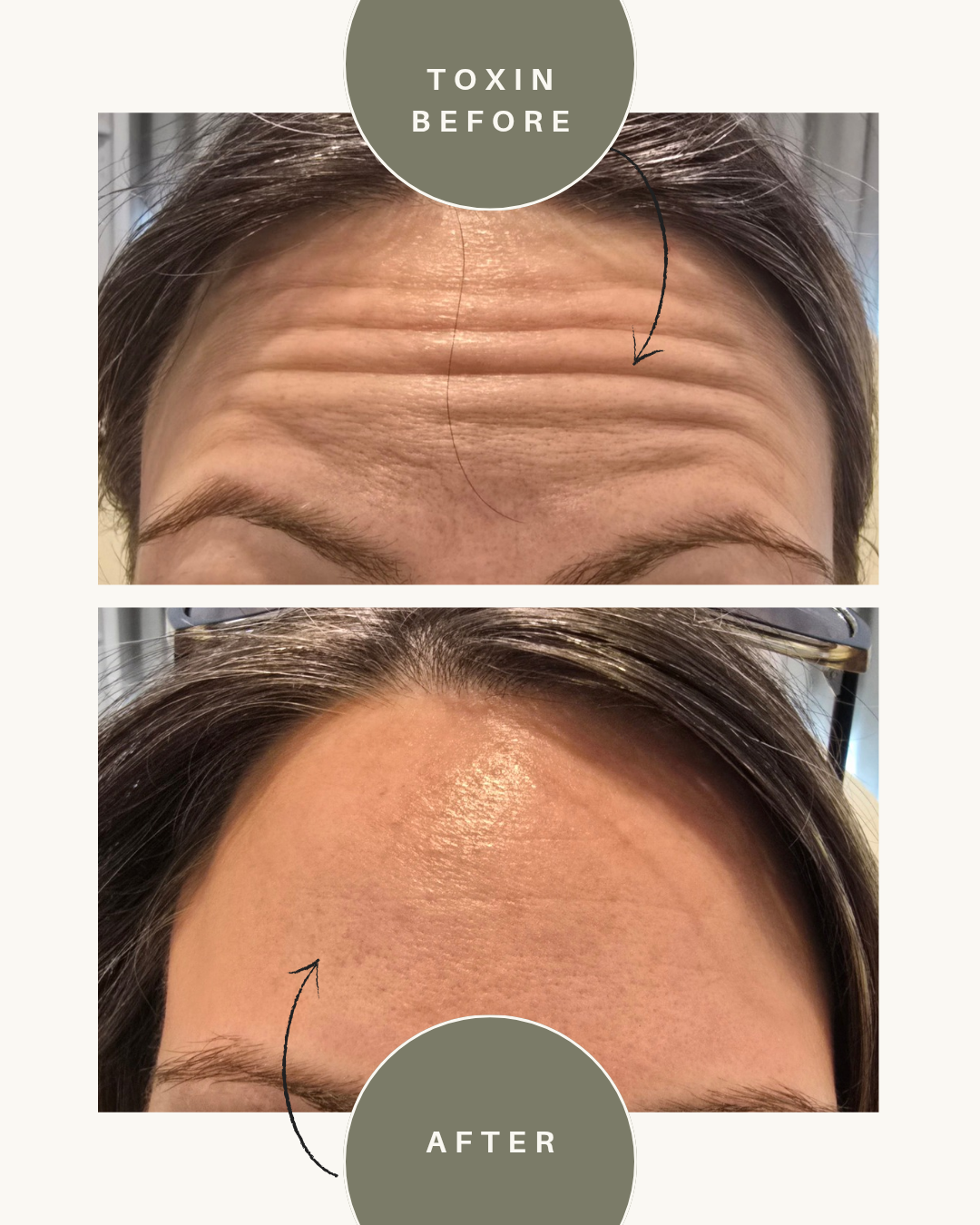 before and after